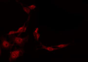 SSTR1 Antibody