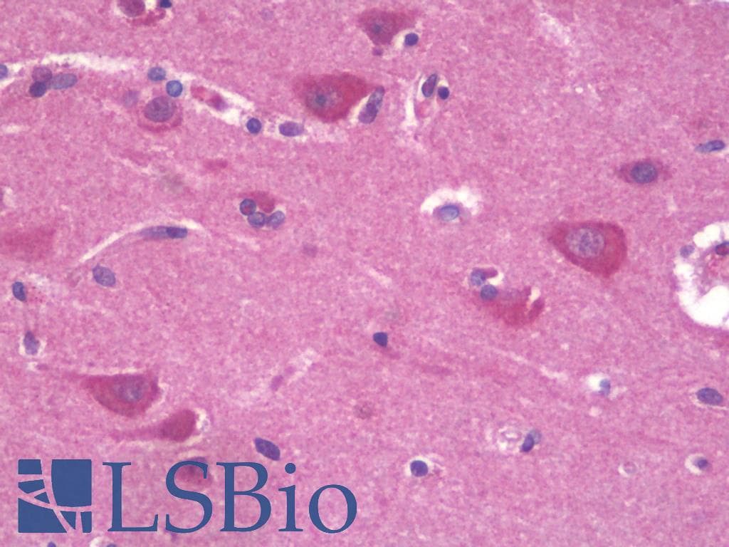 PathPlus™ Polyclonal Rabbit anti-Human FZD3 / Frizzled 3 Antibody (IHC)