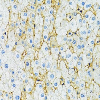 SLC1A2 / EAAT2 / GLT-1 Antibody (aa495-574)