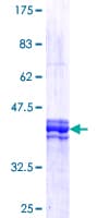 Human FOXM1 Protein (Recombinant GST, N-terminus)