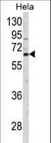 CTP Synthetase 2 / CTPS2 Antibody (aa77-105)