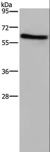 Polyclonal Rabbit anti-Human ART4 Antibody (IHC, WB)