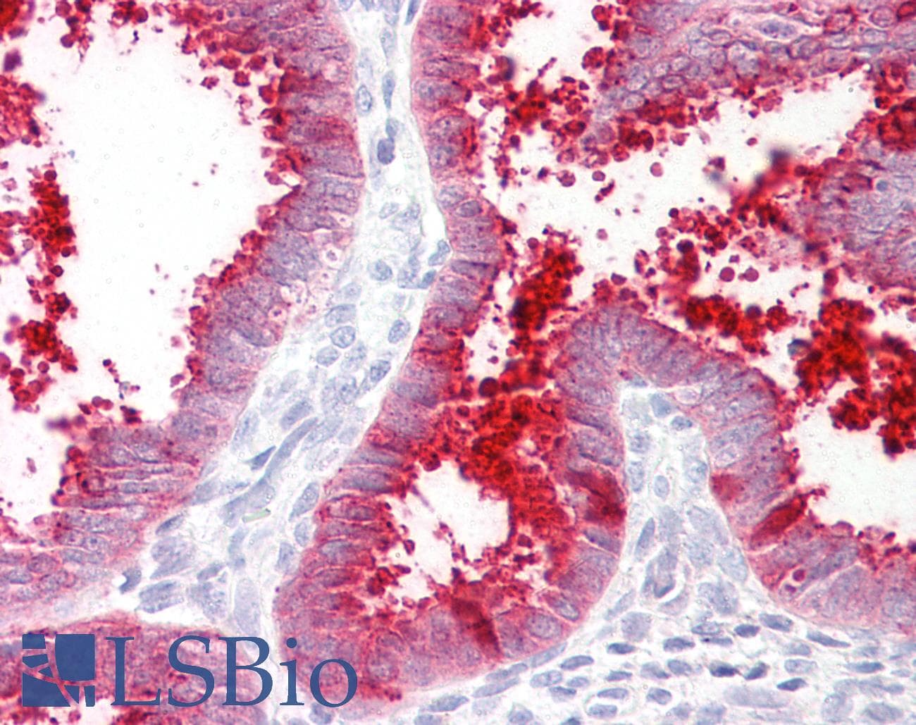 IHC-plus™ MMP7 / Matrilysin Antibody (aa218-267)
