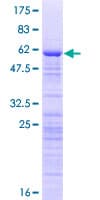 Human ZCCHC17 / PNO40 / PS1D Protein (Recombinant GST)