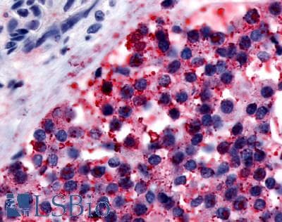 PathPlus™ CALCR / Calcitonin Receptor Antibody (C-Terminus)