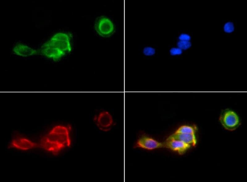 PIEZO1 / FAM38A Antibody