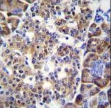 SMYD4 Antibody (aa541-568)