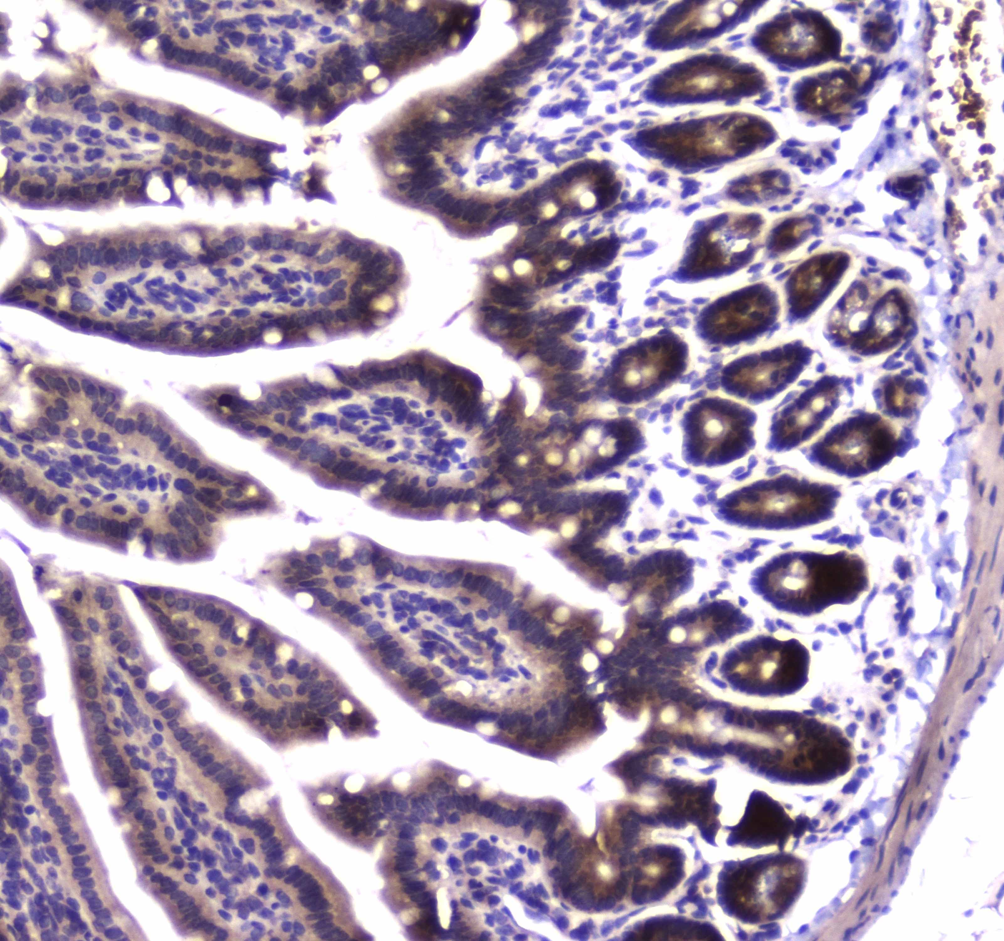 SDHB Antibody