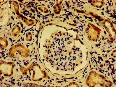 NME6 Antibody