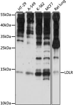 SNRNP25 Antibody
