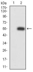 MIB1 Antibody (clone 6A9C9)