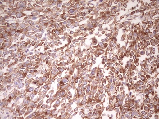FARSB Antibody (clone OTI4B3)