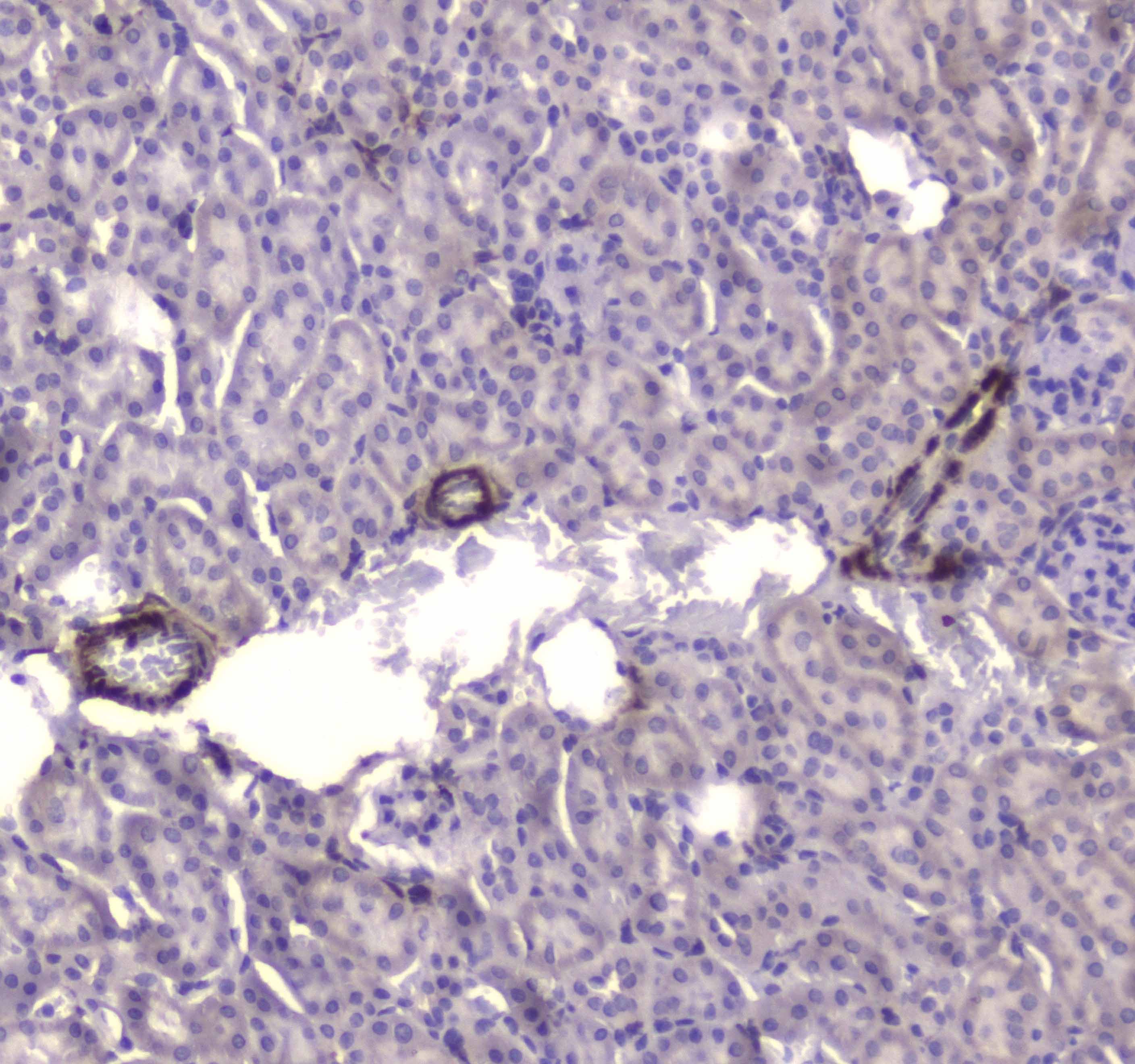 CKB / Creatine Kinase BB Antibody
