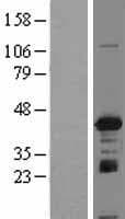 IGBP1 Protein (Over-Expression Lysate Myc-DDK (Flag))