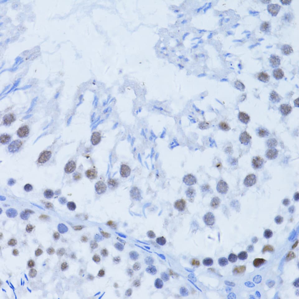 PARP1 Antibody