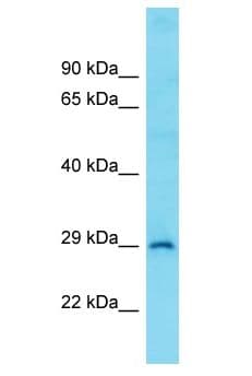 Polyclonal Rabbit anti-Human CCDC34 Antibody (aa150-199, WB)