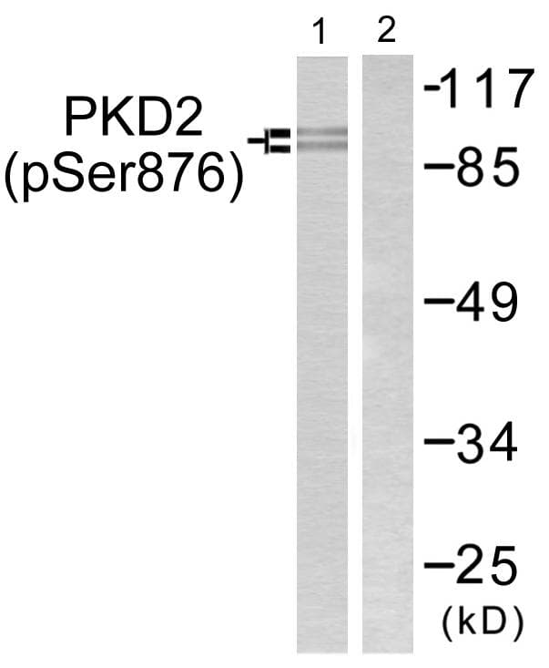 PRKD2 / PKD2 Antibody (phospho-Ser876)