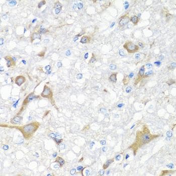 IL22 Antibody