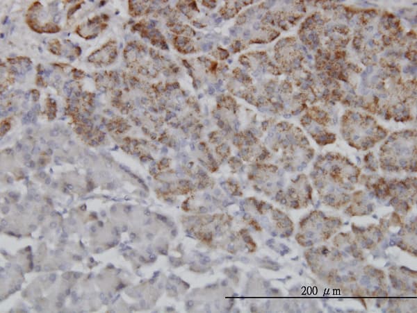 Monoclonal Mouse anti-Human TRIM36 Antibody (clone 2D11, IHC, IF, WB)