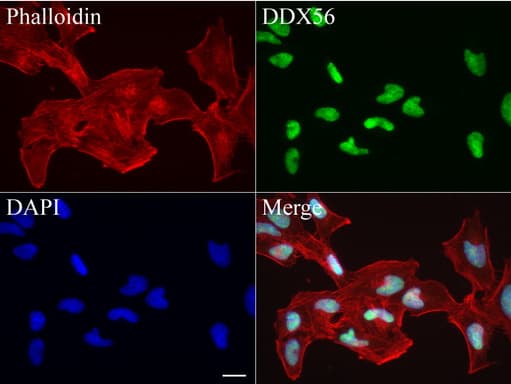 DDX56 Antibody (aa323-547, clone UMAB153)