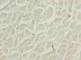 Polyclonal Rabbit anti-Human RASL10B Antibody (IHC)