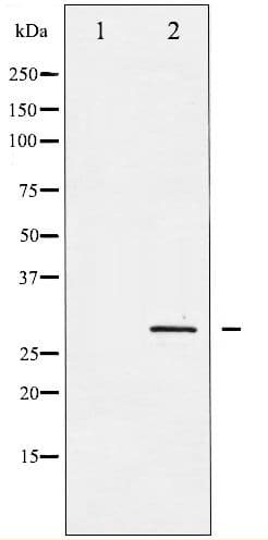 SNAI1 / SNAIL-1 Antibody (phospho-Ser246)
