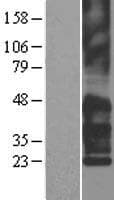 Human TSPAN7 / CD231 Protein (Over-Expression Lysate Myc-DDK (Flag))