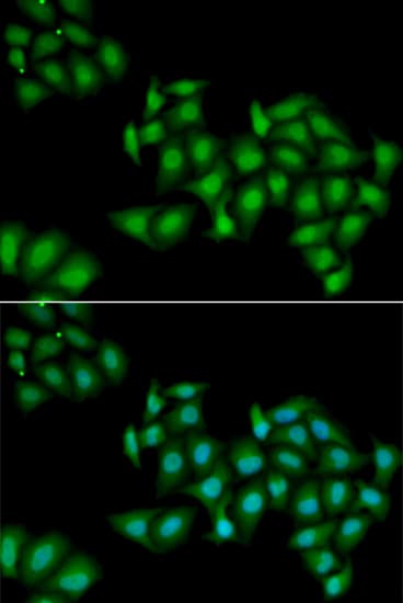 Polyclonal Rabbit anti-Human DDX1 Antibody (IHC, IF, WB)