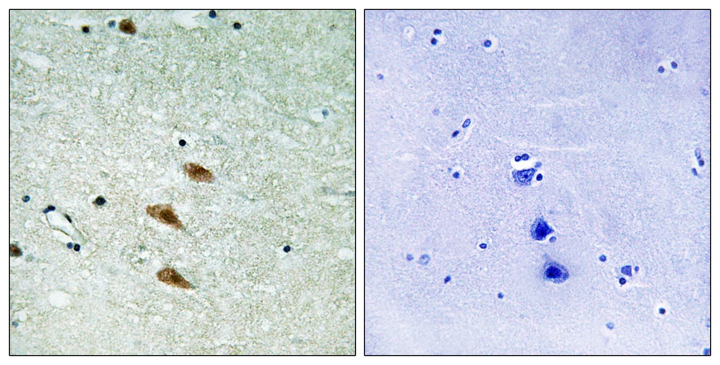 Polyclonal Rabbit anti-Human TOP2A / Topoisomerase II Alpha Antibody (aa1482-1531, IHC, WB)