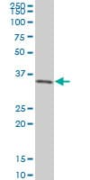 SIX3 Antibody (clone 3D12)