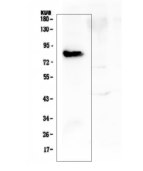 COMP / THBS5 Antibody