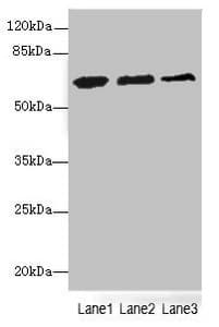 ETFDH Antibody