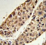 ITIH2 Antibody (aa858-886)