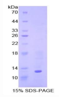 Human BMP7 Protein (Recombinant His)