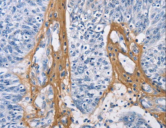 PathPlus™ COL3A1 / Collagen III Antibody