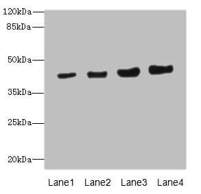 Polyclonal Rabbit anti-Human PPM1A / PP2CA Antibody (IHC, WB)