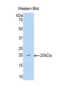 PathPlus™ HEXB Antibody (aa294-435)