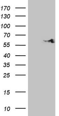 Monoclonal Mouse anti-Human SHMT / SHMT2 Antibody (clone OTI5H10, WB)