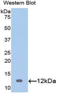 S100A1 / S100-A1 Antibody (aa1-94)
