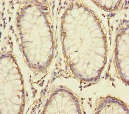 BCMP84 / S100A14 Antibody