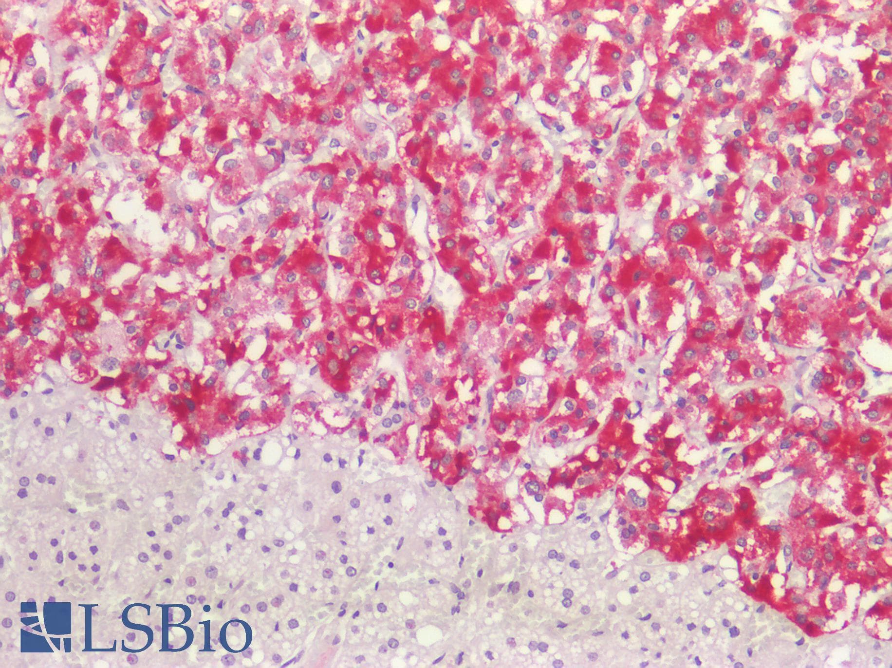 PathPlus™ ACVRL1 Antibody (aa196-245)