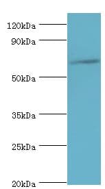 Polyclonal Rabbit anti-Human GAD1 / GAD67 Antibody (aa1-200, IHC, WB)