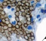 GYPA / CD235a / Glycophorin A Antibody (clone GA-R2)