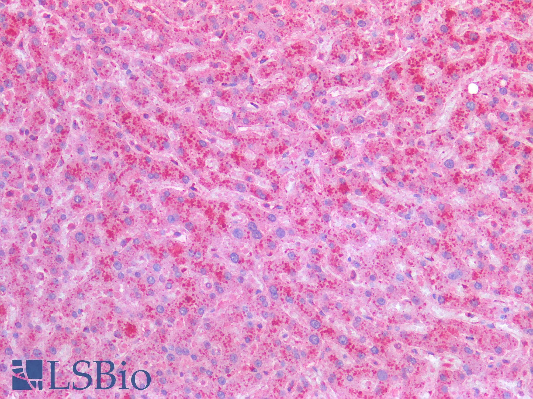 PathPlus™ Polyclonal Rabbit anti-Human HEXB Antibody (IHC)