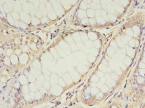 TIMM10 Antibody (aa1-90)
