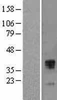 Human TFPI / LACI Protein (Over-Expression Lysate Myc-DDK (Flag))
