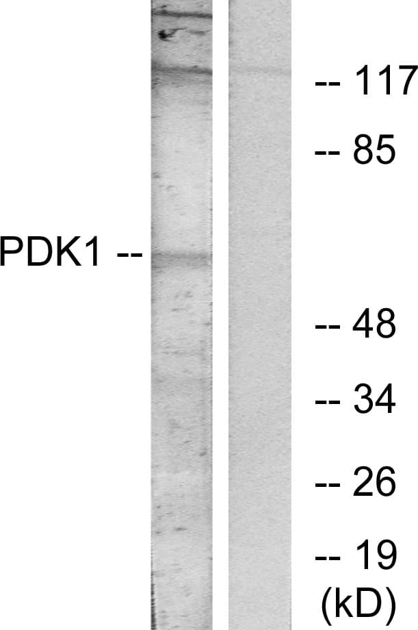 Polyclonal Rabbit anti-Human PDPK1 / PDK1 Antibody (aa210-259, IHC, WB)