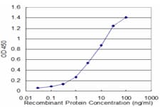 NBR1 Antibody (clone 6B11)