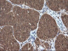 CTAG1B / NY-ESO-1 Antibody (clone OTI4B11, Carrier-free)