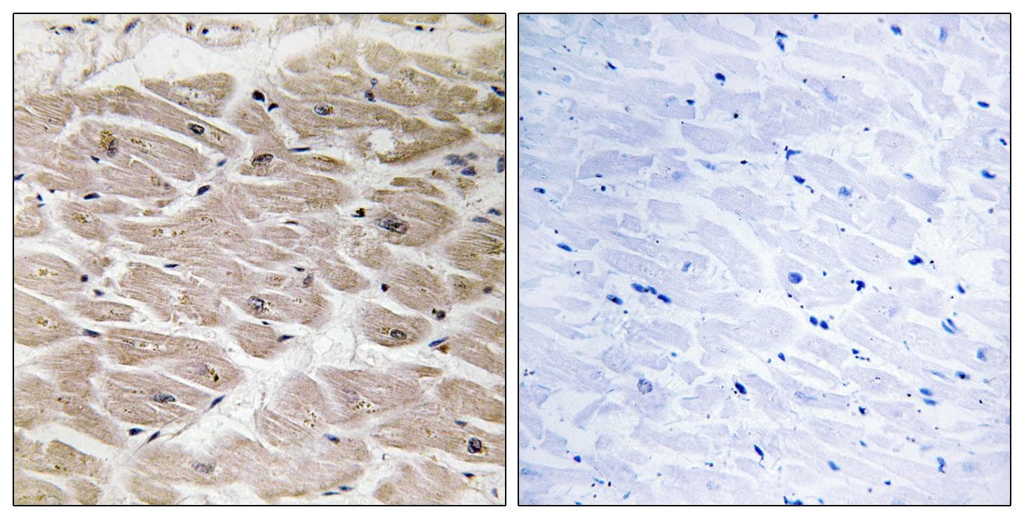 AGBL2 / CCP2 Antibody